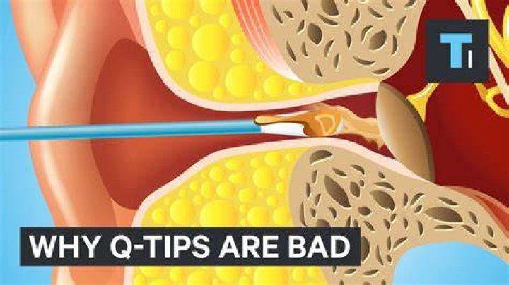 Are Q-Tips bad for ears?