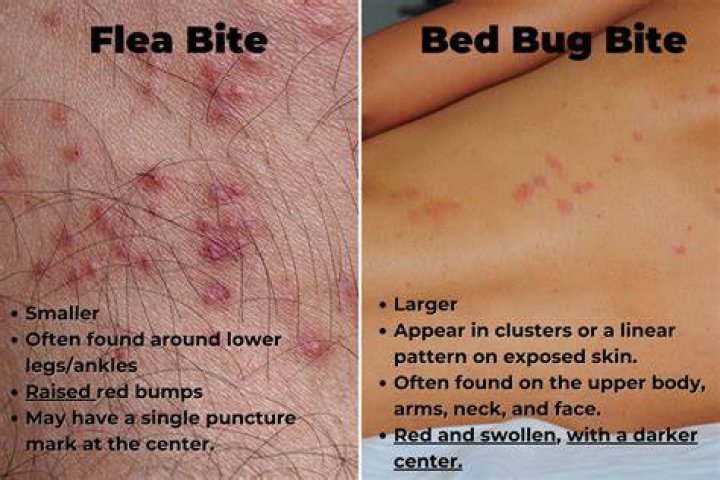 Can bed bug bites cause anaphylaxis?