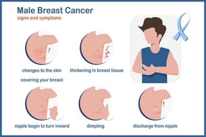 Can men get breast cancer from pinching?