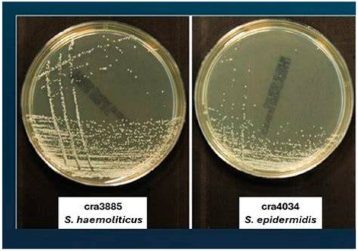 Can Staph epidermidis cause bacteremia?