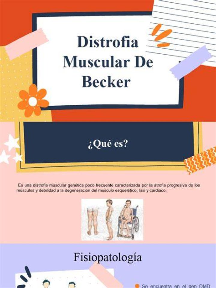 Como aliviar la distrofia muscular de Becker?