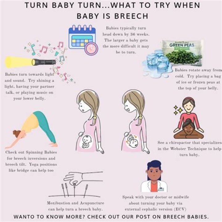 Do breech babies cause back pain?