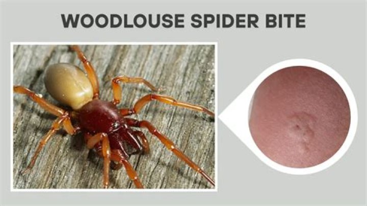 Do woodlice spiders bite?