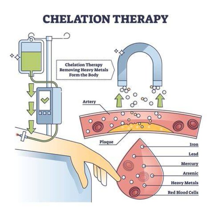 Does chelation remove heavy metals?