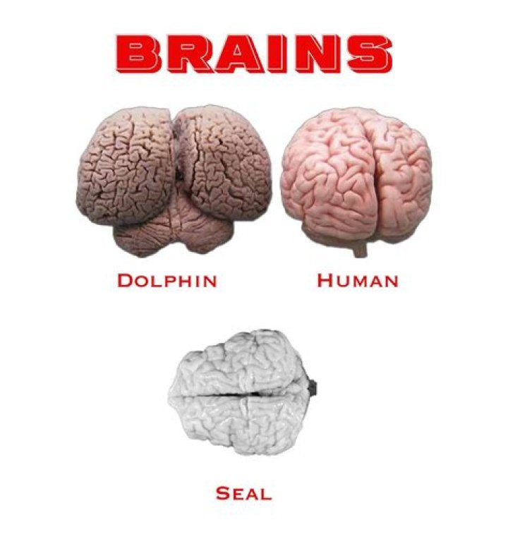 How are dolphin brains different from humans?