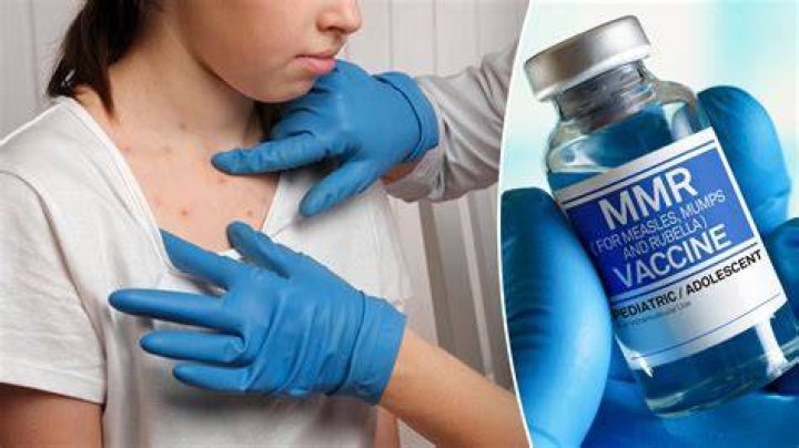 How common is a reaction to MMR vaccine?