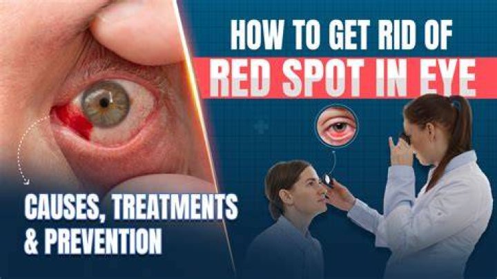 How do I get rid of red spots on my glans?