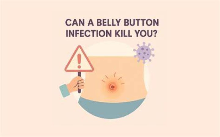 How do you know if your belly button is infected after surgery?