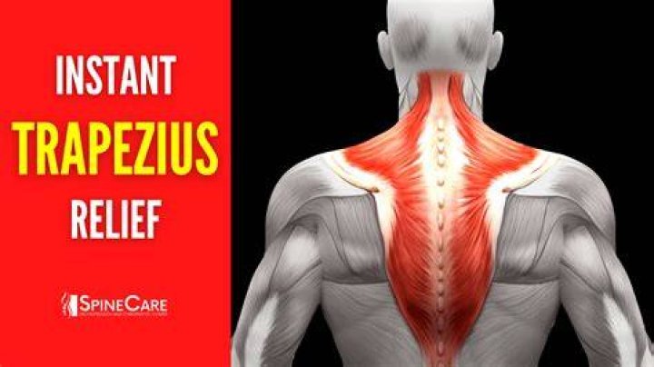 How do you relieve a trapezius muscle cramp?