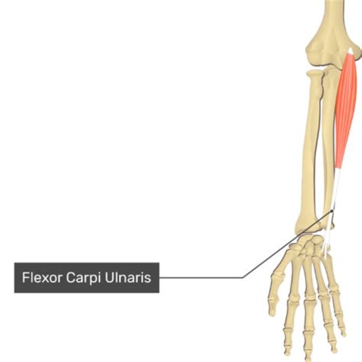 How do you treat flexor carpi ulnaris?