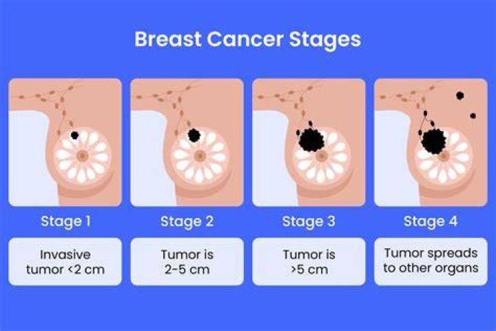How many cancer centers are in Ireland?