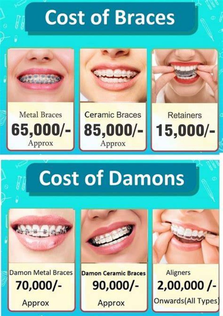 How much do teeth braces cost?