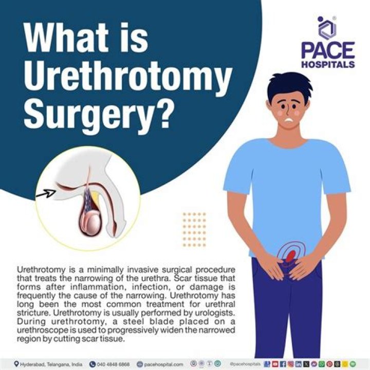 How successful is a Urethrotomy?