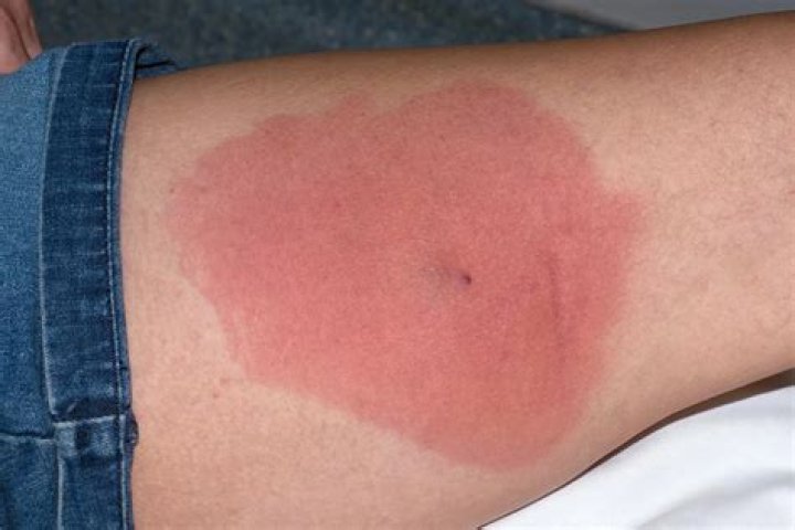 Is MRSA sensitive to Levaquin?