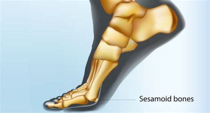 What are examples of sesamoid bones?