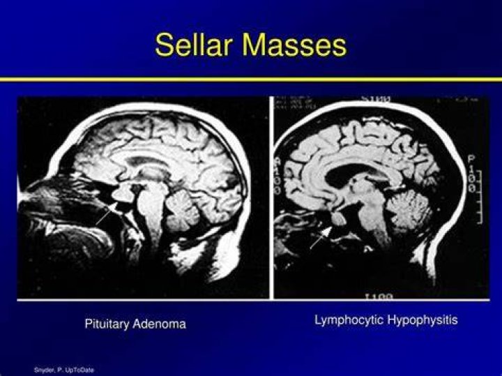 What are Sellar masses?