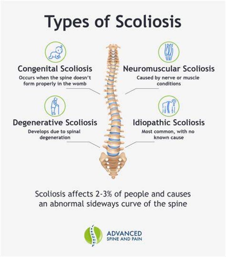 What are the main causes of scoliosis?