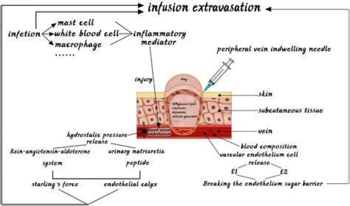 What are the treatment options for extravasation with doxorubicin?