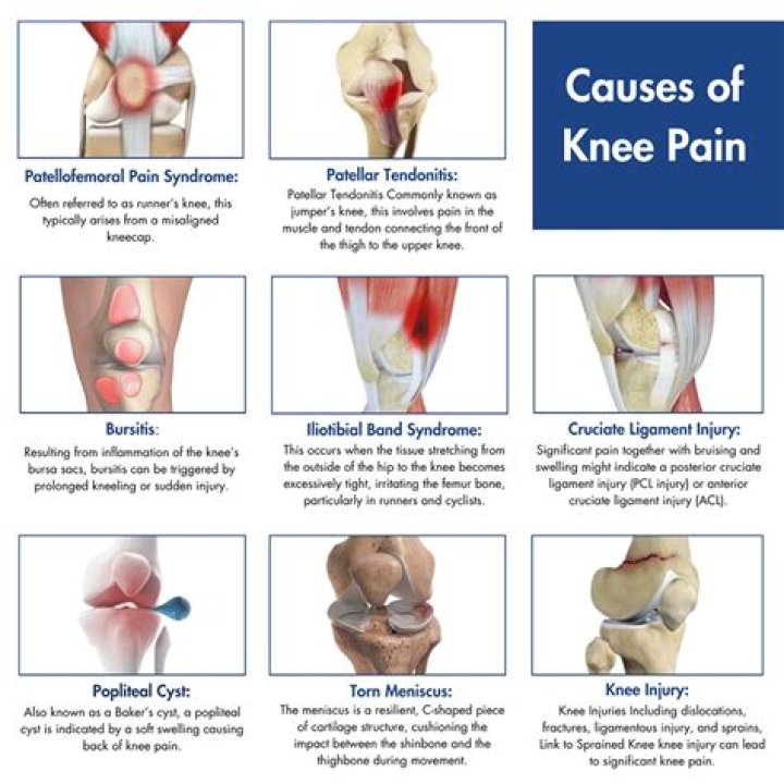 What causes knee swelling without pain?