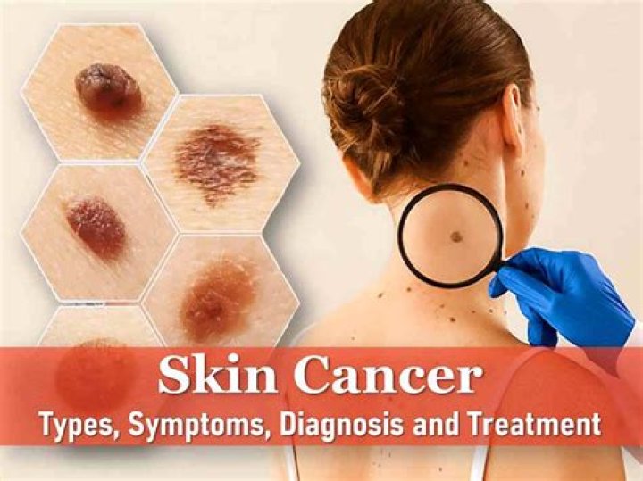 What do tumors on the skin look like?
