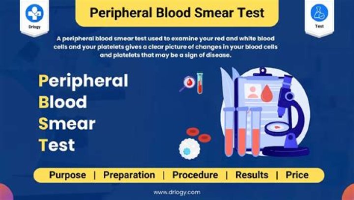 What does an increase of band cells in peripheral blood indicate?