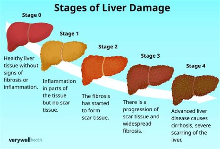 What does liver do for acne?