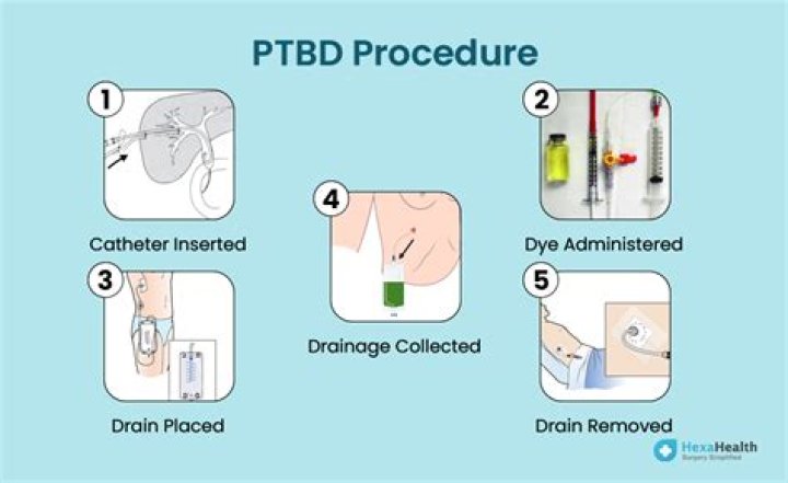 What does PTBD mean in medical terms?