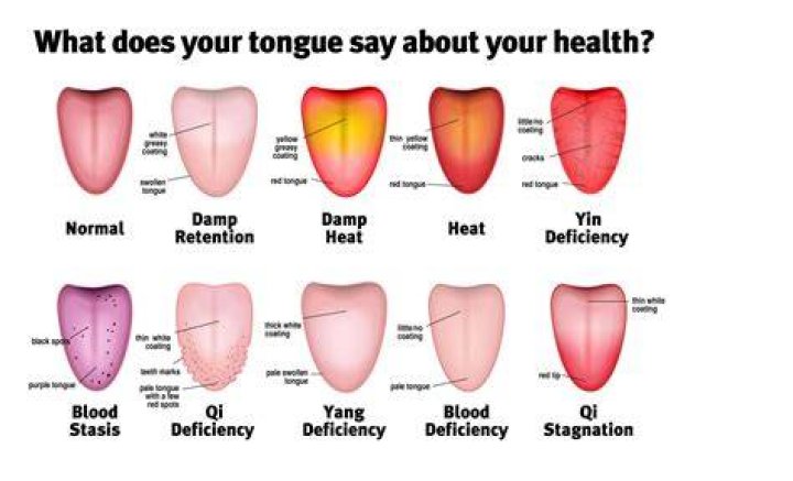 What does tongue color tell you?