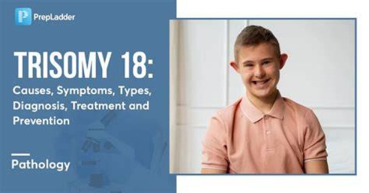 What does trisomy 18 look like?