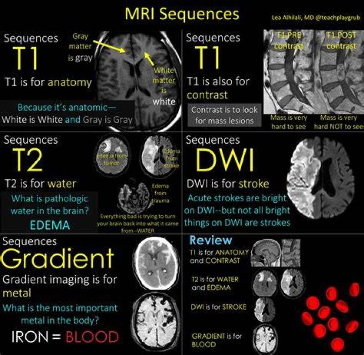 What is a diffusion gradient MRI?