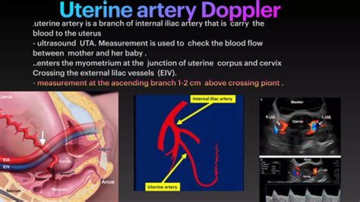 What is abnormal uterine artery Doppler?