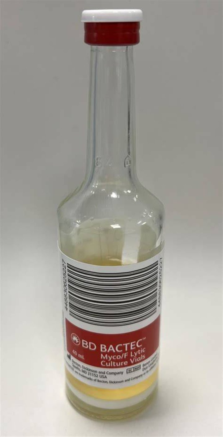 What is bactec blood culture?