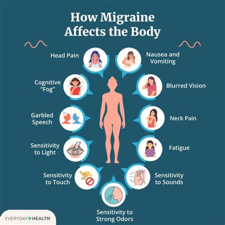 What is Mav migraine?