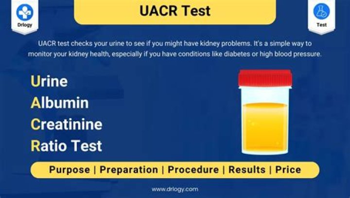 What is normal random urine calcium level?