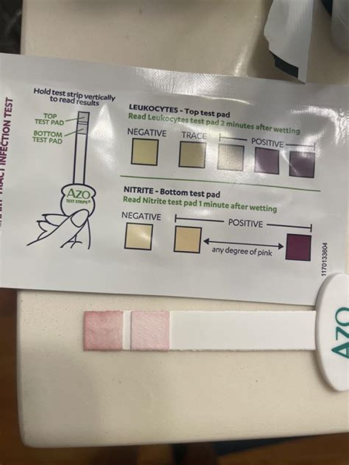 What is Renzulli test?