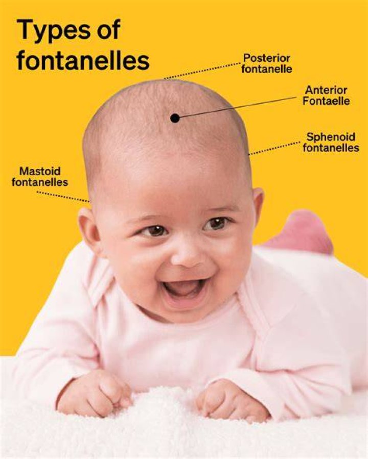 What is the causes for a large fontanelle in infants?