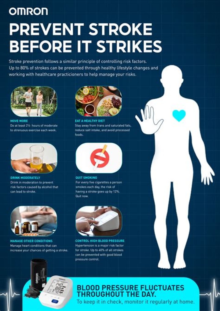 What is the most common cardiac cause for stroke?