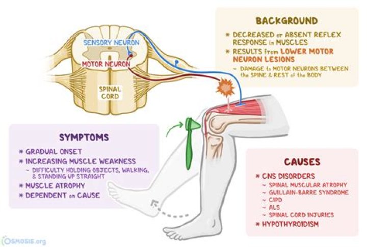 What is the pathophysiology of hyperreflexia?