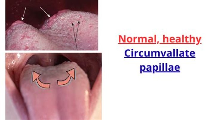 What is the renal papillae?