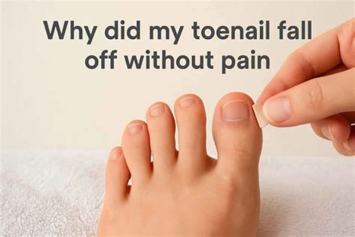 What serious illness makes your toenails fall off?