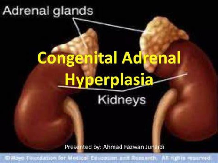 When is congenital adrenal hyperplasia diagnosed?