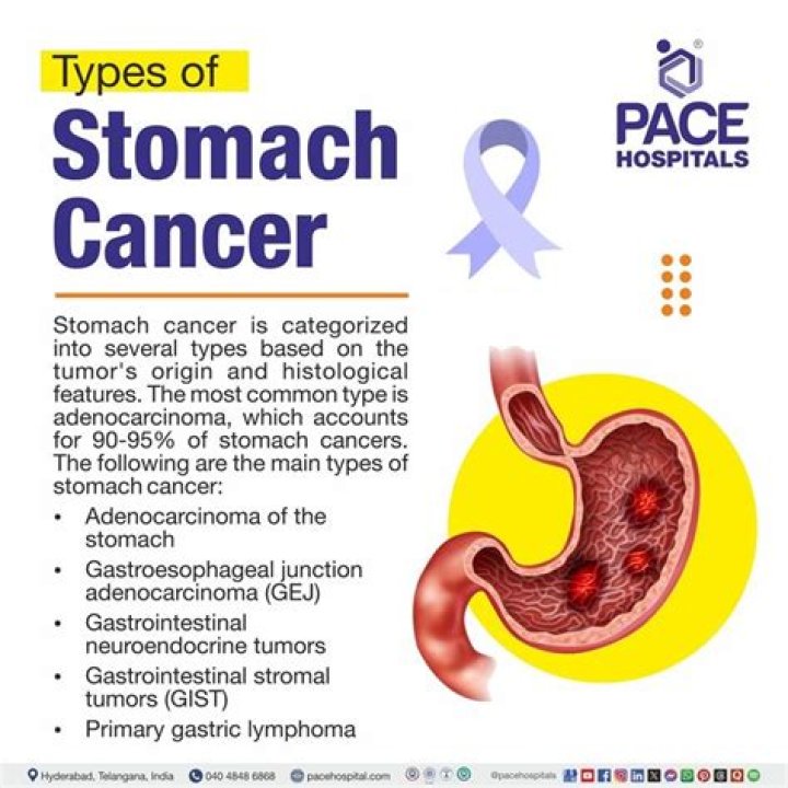 Which 3 components of the stomach are the most common sites of gastric cancer in the US?