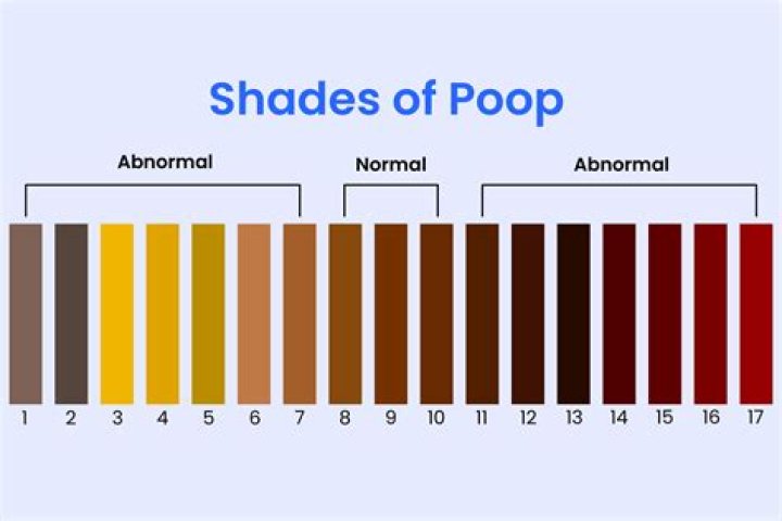 Why is my poop a light cream color?