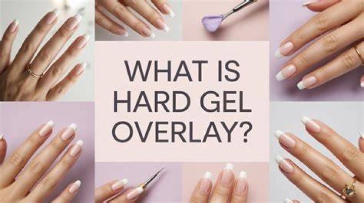 Why should you overlay the gel?